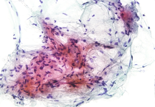 C2: Benign - Eurocytology