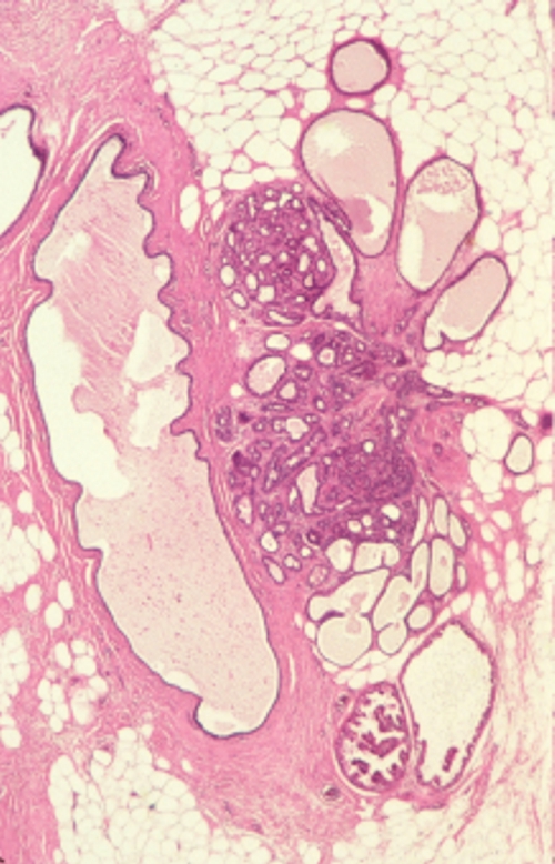 Anatomy and histology of the breast - Eurocytology