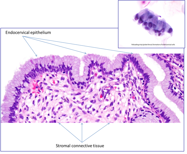 endocervix histology