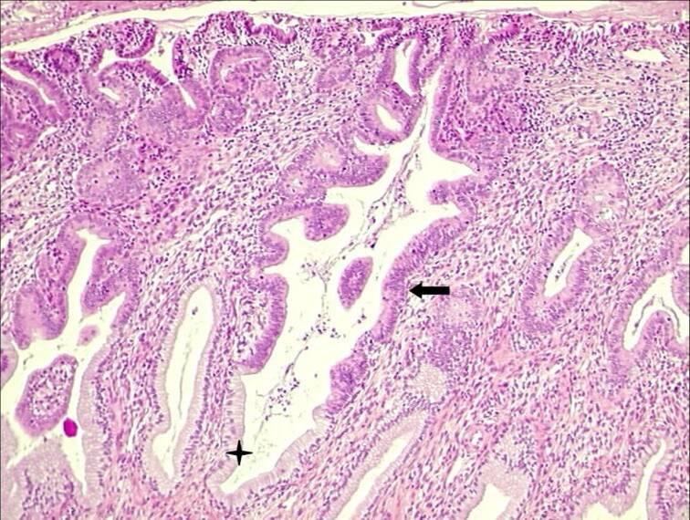 histología del endocérvix