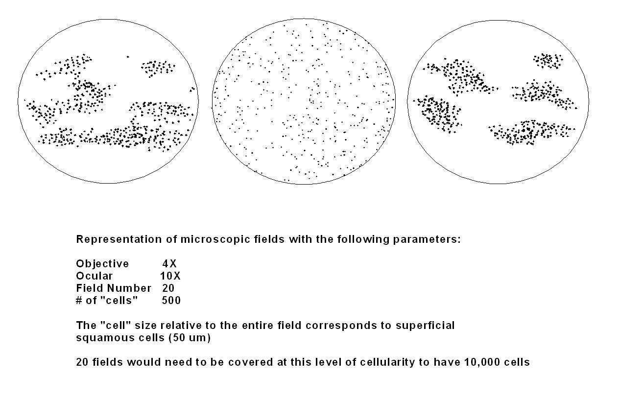 liquid based cytology